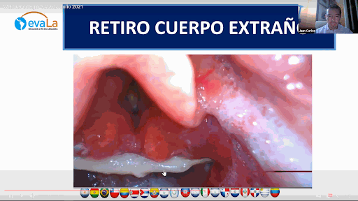 Odoo • Text and Image