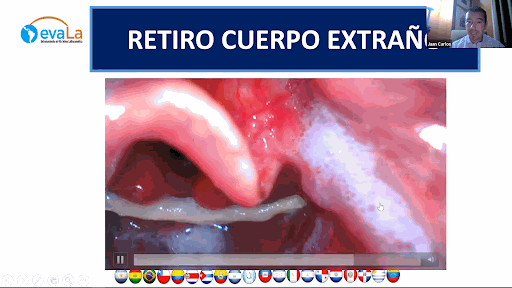 Odoo • Image and Text