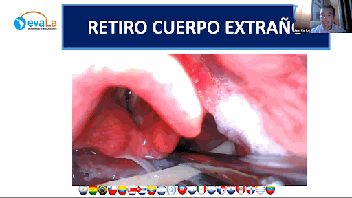 Odoo • Text and Image