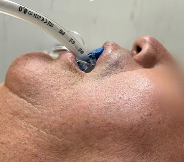 Odoo • Image and Text