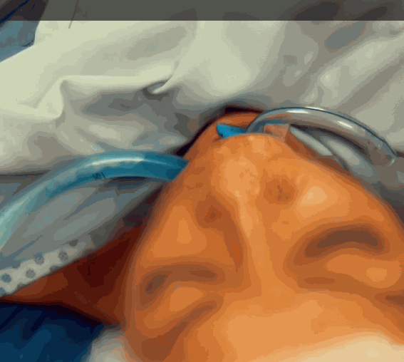 Odoo - Prueba 3 a tres columnas