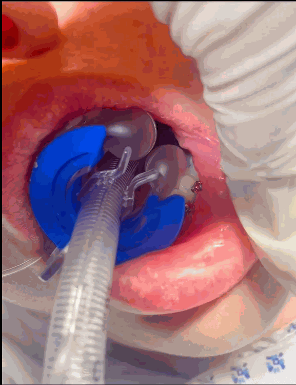 Odoo • Text and Image