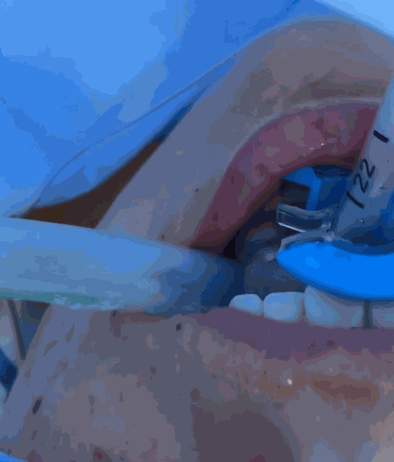 Odoo - Prueba 1 a tres columnas