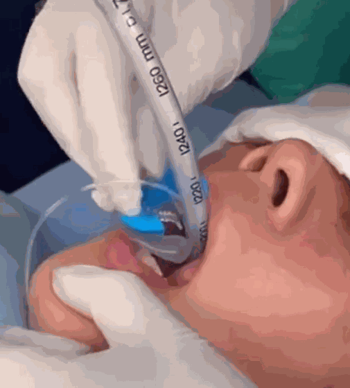 Odoo • Text and Image