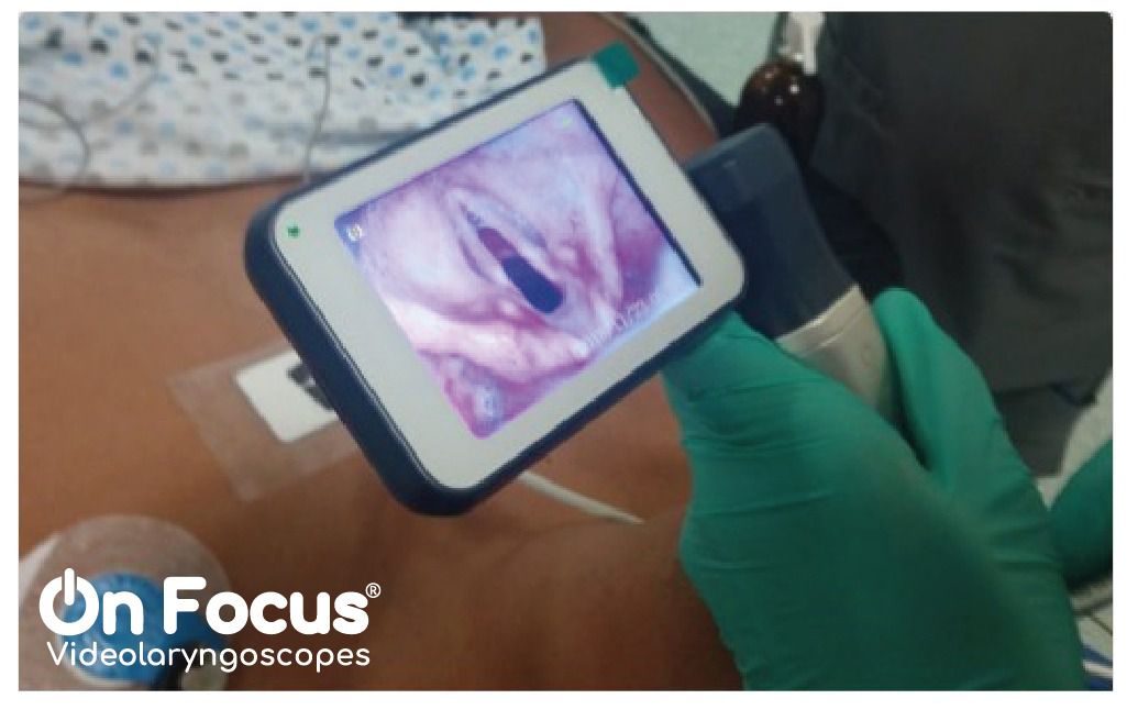 Odoo - Prueba 1 a tres columnas